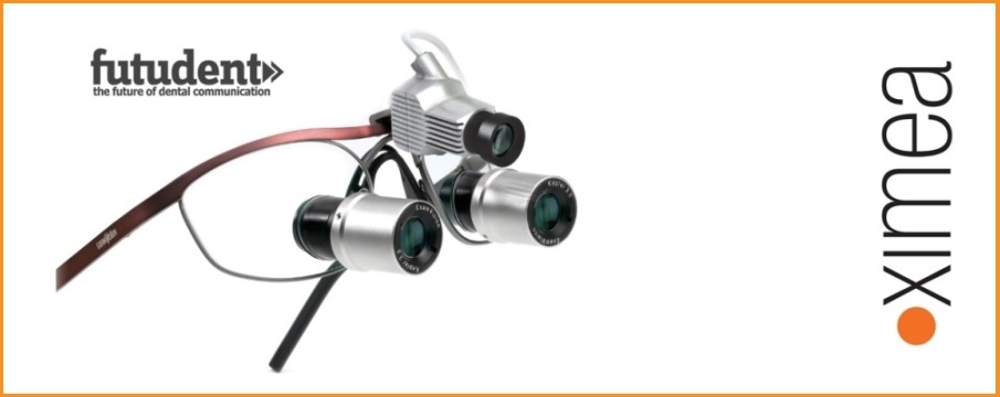 New-kind-of-dentist-system-is-getting-popular-futudent-ximea-camera
