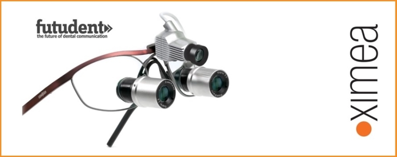 New-kind-of-dentist-system-is-getting-popular-futudent-ximea-camera