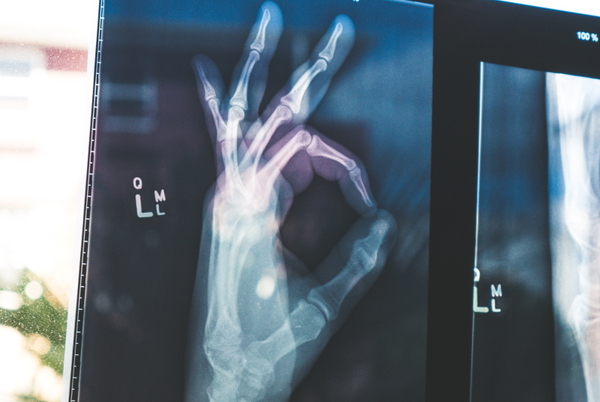 Life-Science-micro-nano-ct-computed-tomography-radiography-medical-biology-applications
