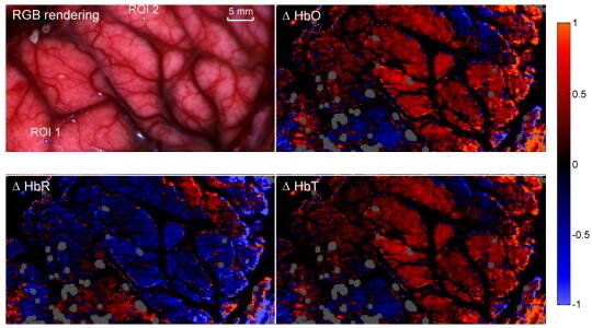 snapshot-hyperspectral-imaging-oxygenation-map-brain-surgery-in-vivo-fluorescence