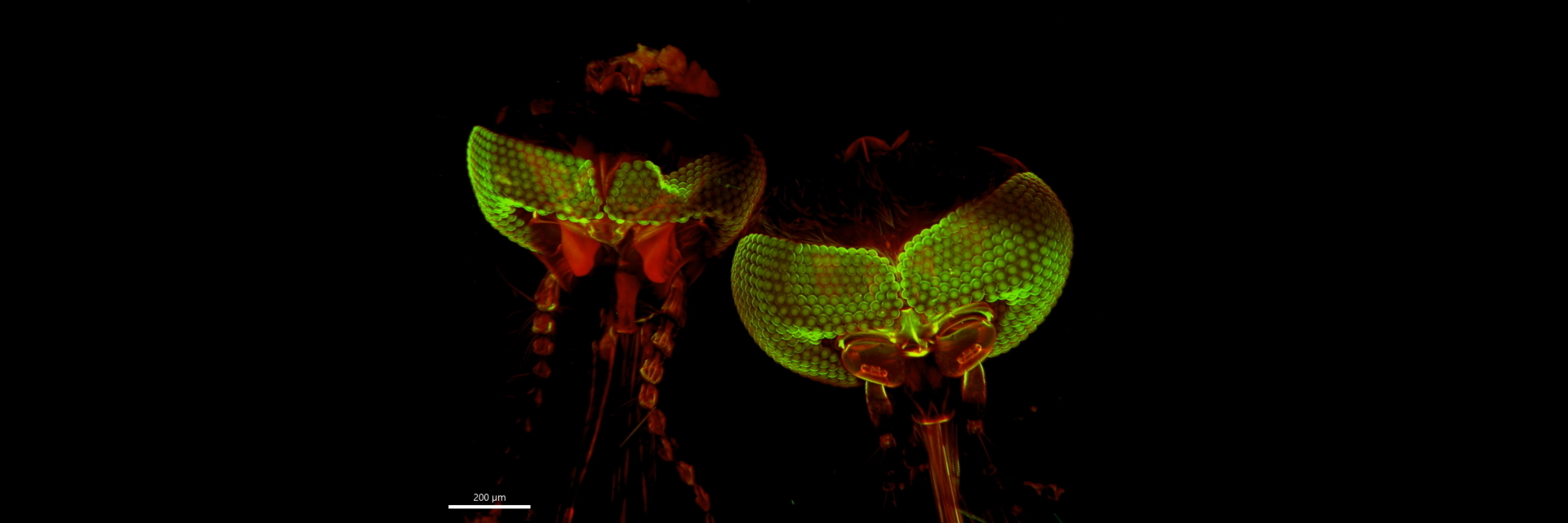 Fluorescence Microscopy