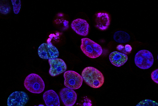 Scientific-cell-sorting-microfluidics-neurology-fluorescence-microscopy-applications